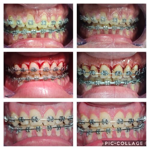 دار عافية أسنان (4)