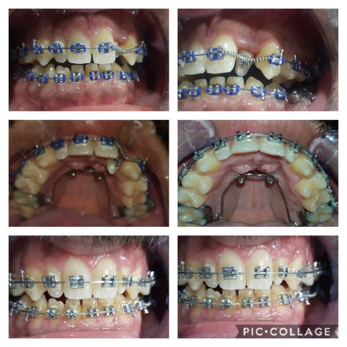 دار عافية أسنان (6)