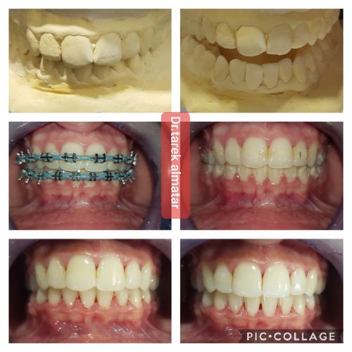 دار عافية أسنان (7)