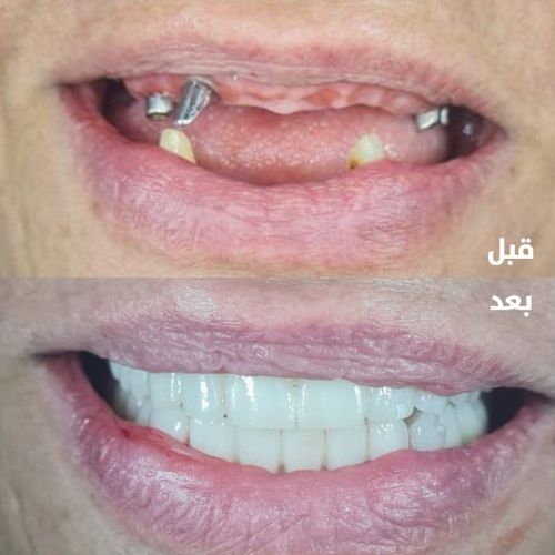 دار عافية حالات اسنان (1)