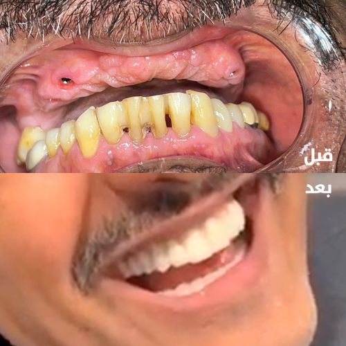 دار عافية حالات اسنان